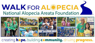 walk for alopecia group photos